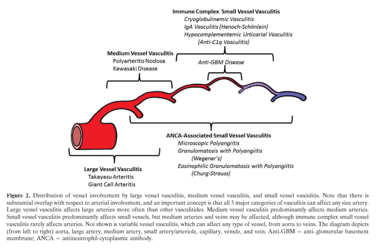 Анализ на васкулит. Системные васкулиты классификация. Аортоартериит Такаясу патогенез. Болезнь Такаясу патогенез. Chapel Hill классификация васкулитов.