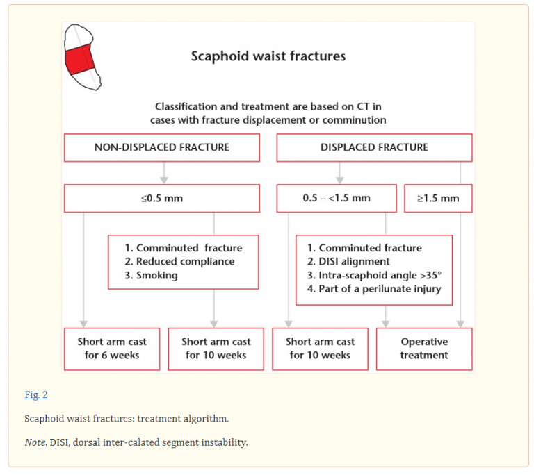 Scaphoid waist fractures