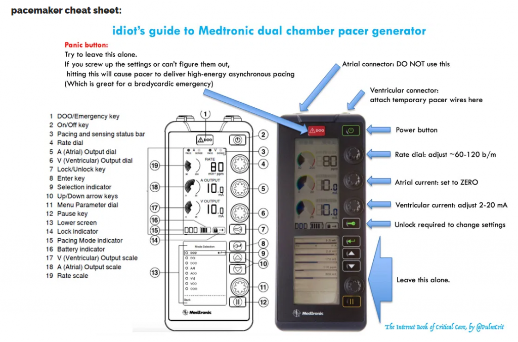 why bradycardia is dangerous: physiology review