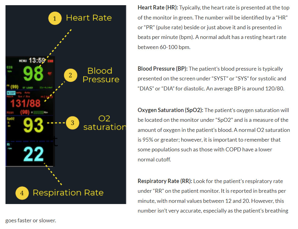 How to Read a Patient Monitor: Numbers and Lines Explained