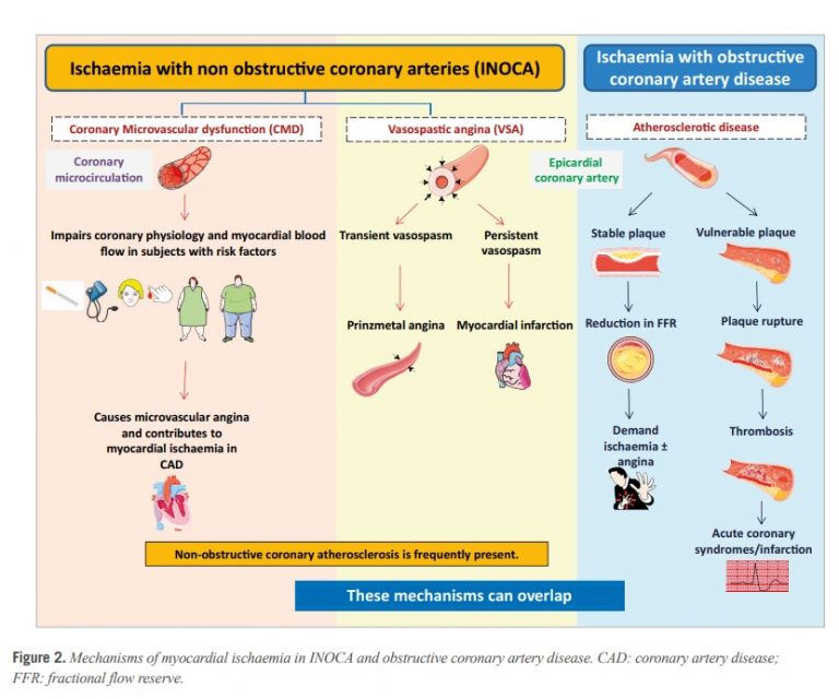 MICROVASCULAR ANGINA